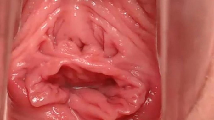 Ein Gescheiterter Versuch: Ein Selbstgemachtes Video Mit Schlechter Ausführung